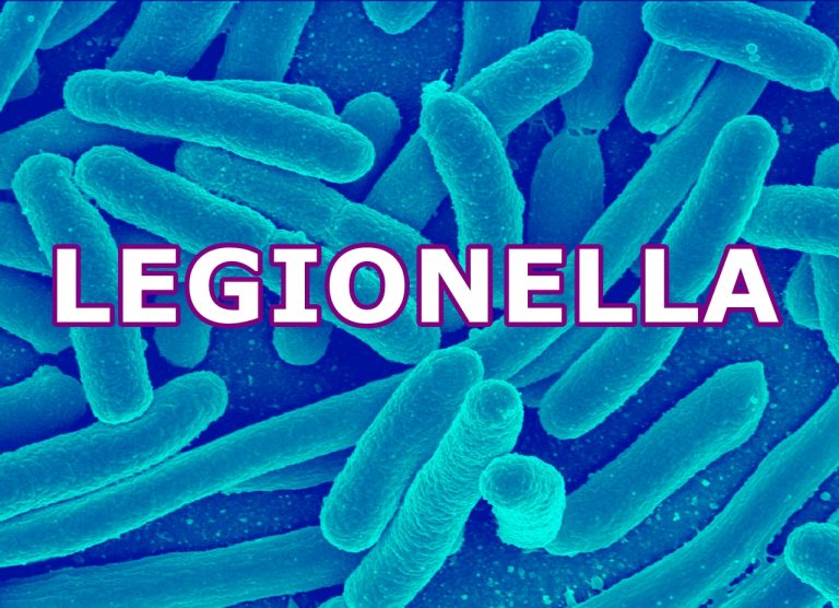 Informacja ws. zakażeń bakterią Legionella pneumophila